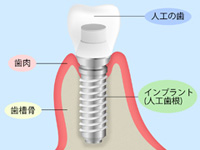 カムログインプラント